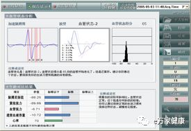 精神压力分析仪